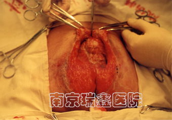 手术中
